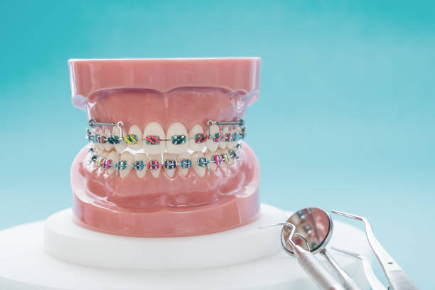 dental braces Adelaide